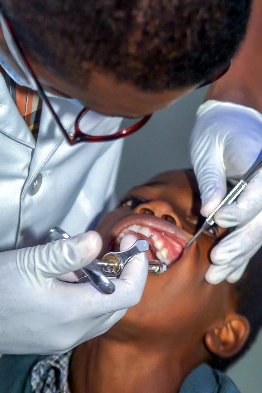 Common Dental Suture Issues and How to Avoid Them - Dental Sutures