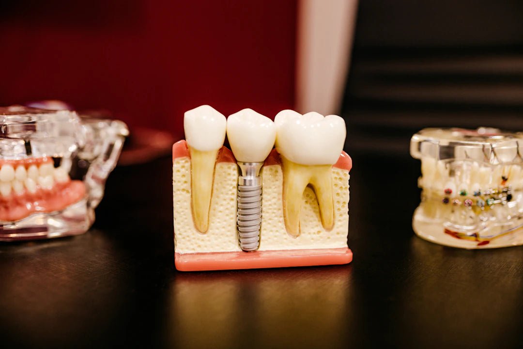 Innovative Closure Techniques in Dentistry for Modern Practices