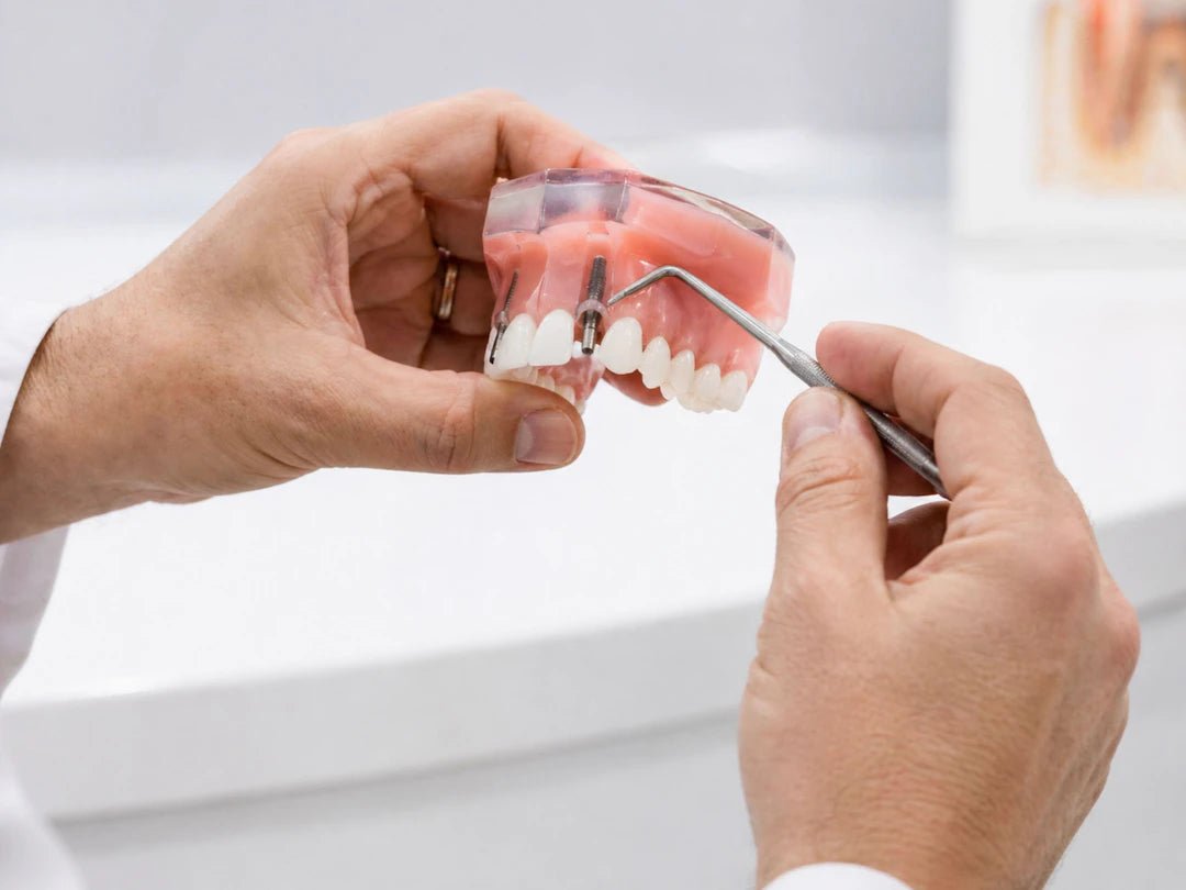 Mastering Patient Expectations After Dental Surgery - Dental Sutures