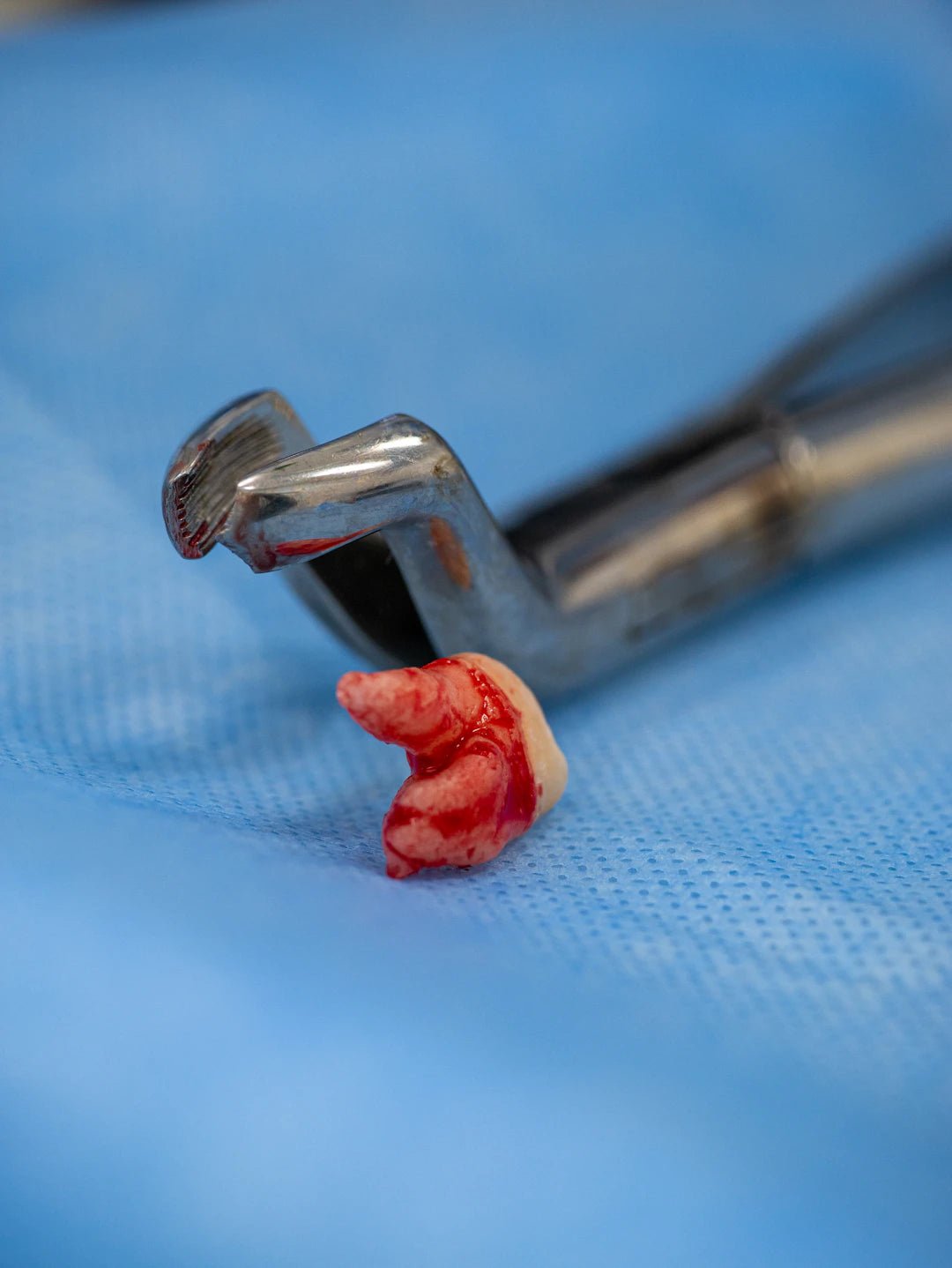 The Fascinating Journey of Dental Sutures - Dental Sutures