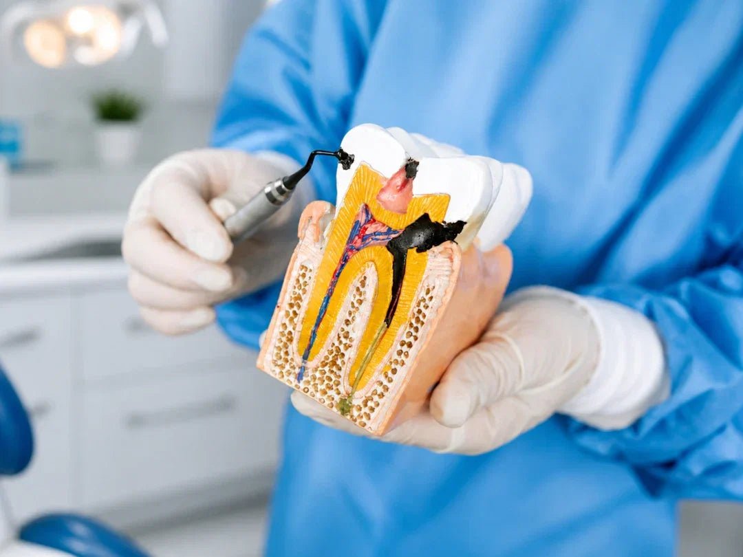 Top FAQs About Dental Sutures for Patients
