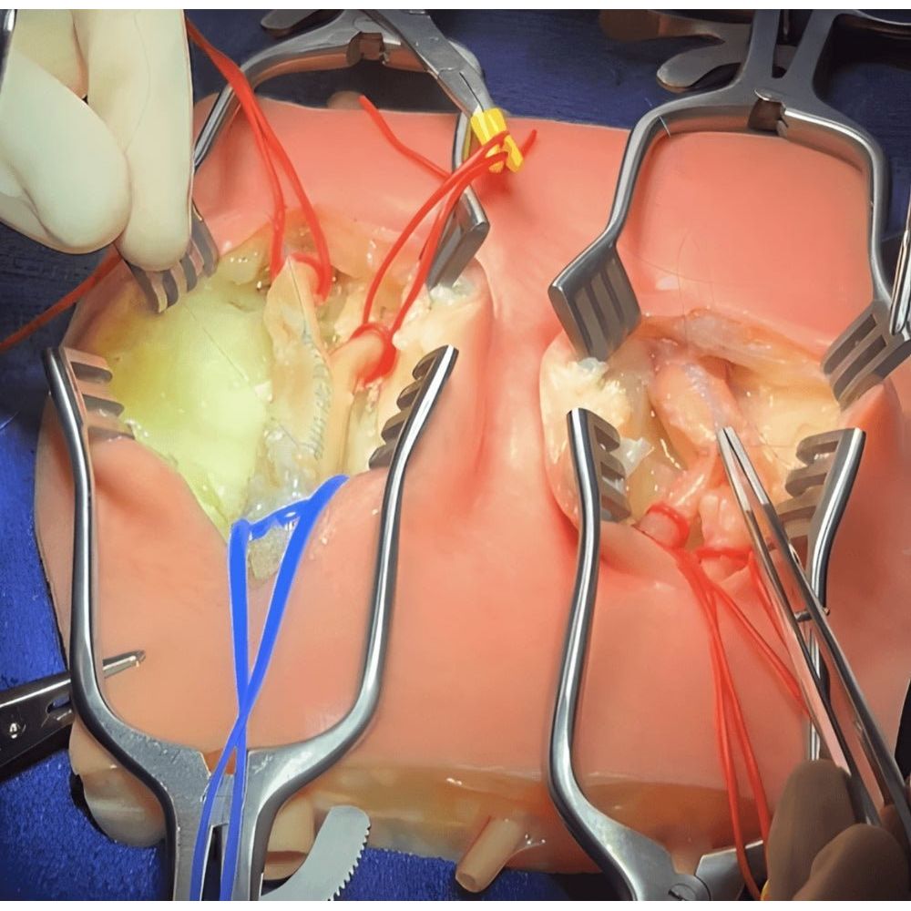 Precision Dermal Embedded Carotid Arteries with Plaque and Dermis Model | Carotid Endarterectomy Training Simulator UK LL-TRN-0244