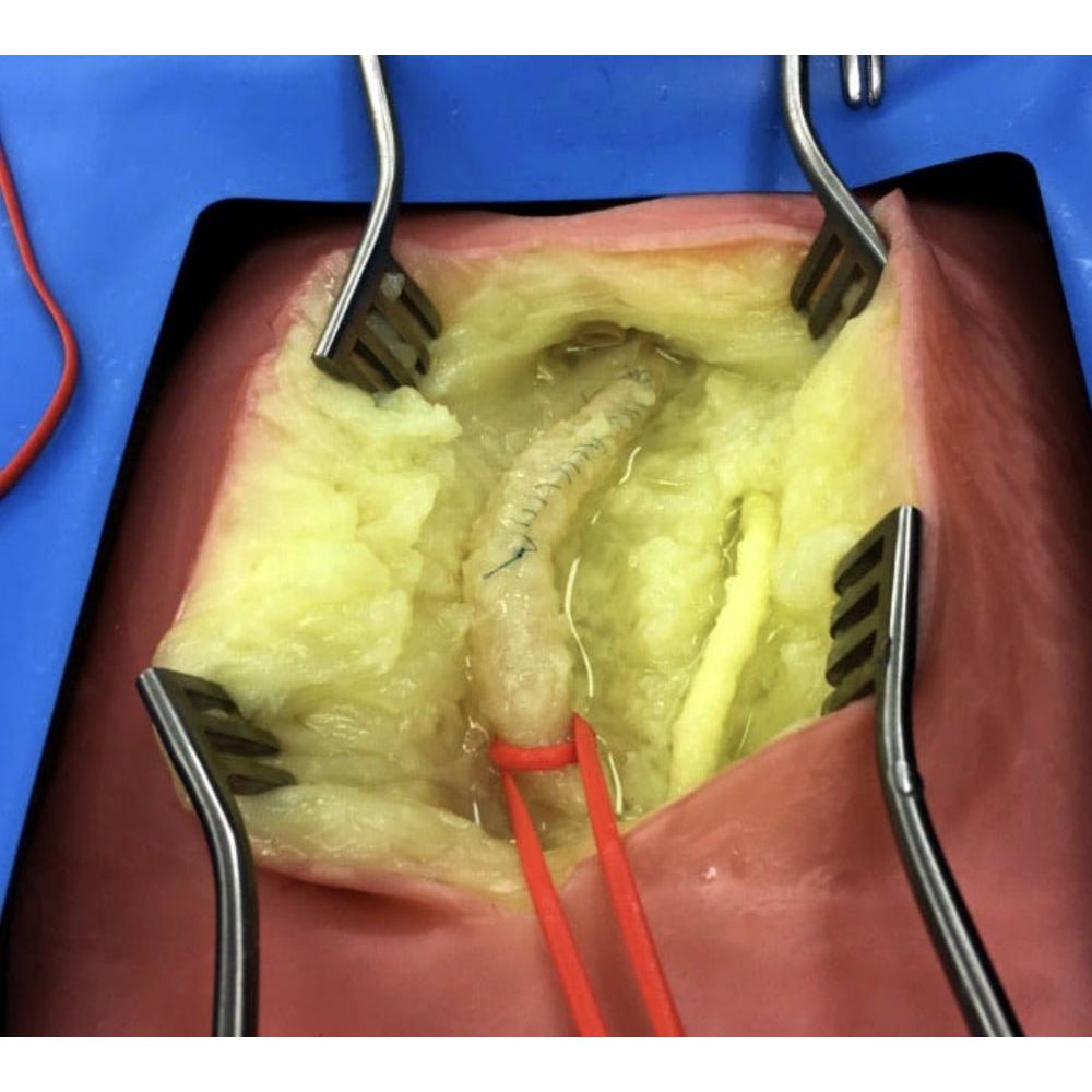 Precision Dermal Embedded Femoral Groin Model | Femoral Endarterectomy Training Simulator UK LL-TRN-0250