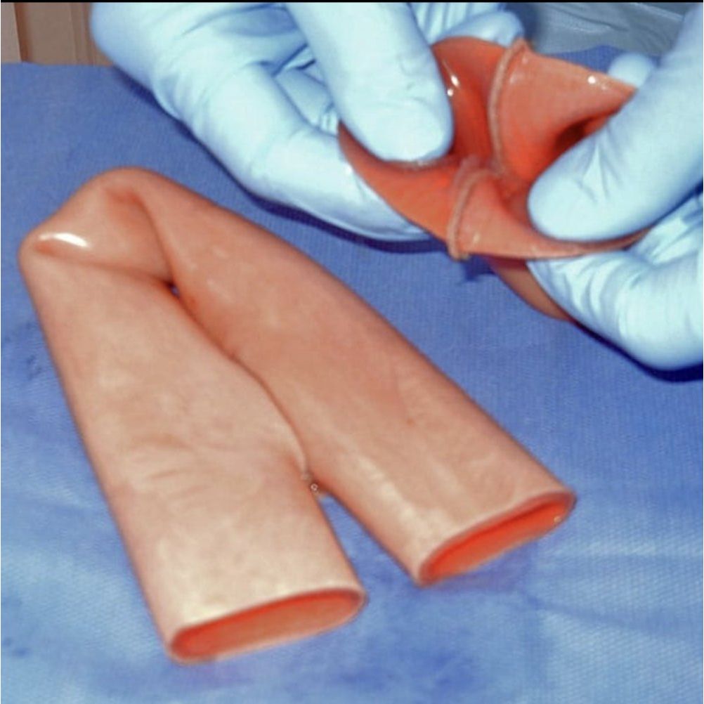 Precision Dermal Double Layer Bowel | Surgical Anastomosis Training Model UK LL-TRN-0304