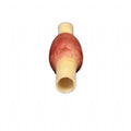 Precision Dermal Ectopic Pregnancy Model | OB - GYN Surgical Training Simulator UK LL-TRN-0507