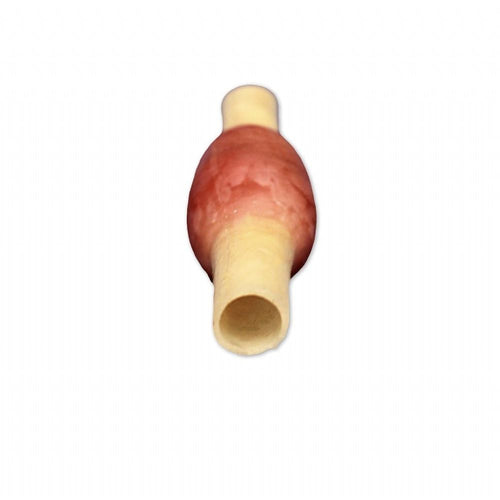 Precision Dermal Ectopic Pregnancy Model | OB - GYN Surgical Training Simulator UK LL-TRN-0507