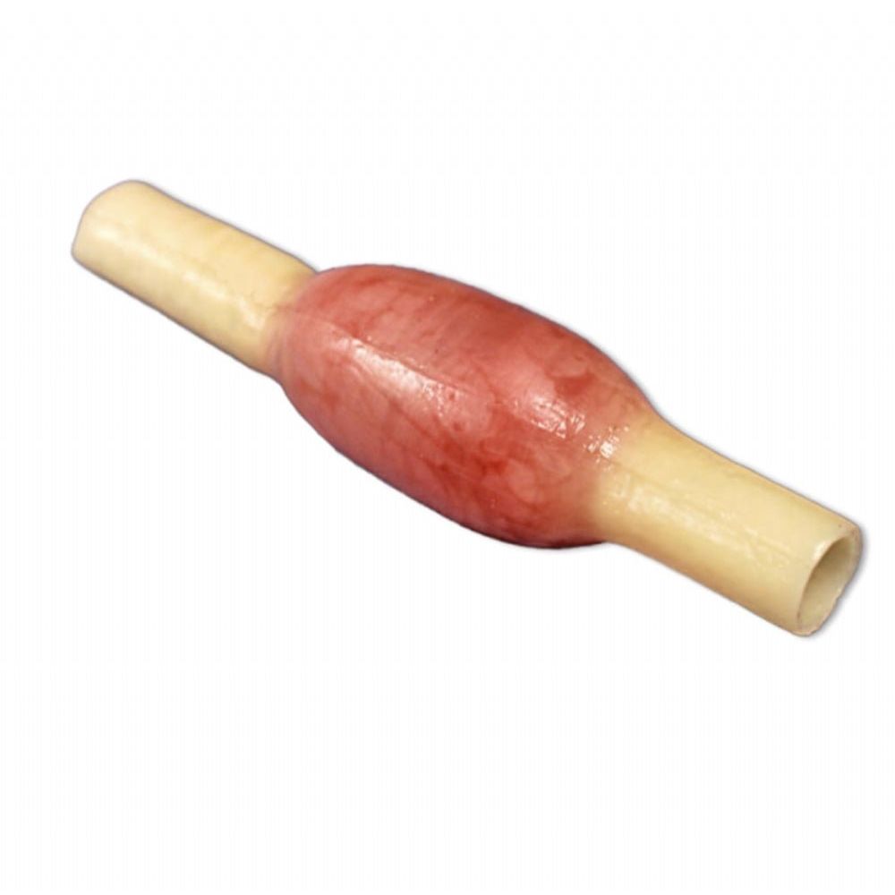 Precision Dermal Ectopic Pregnancy Model | OB - GYN Surgical Training Simulator UK LL-TRN-0507