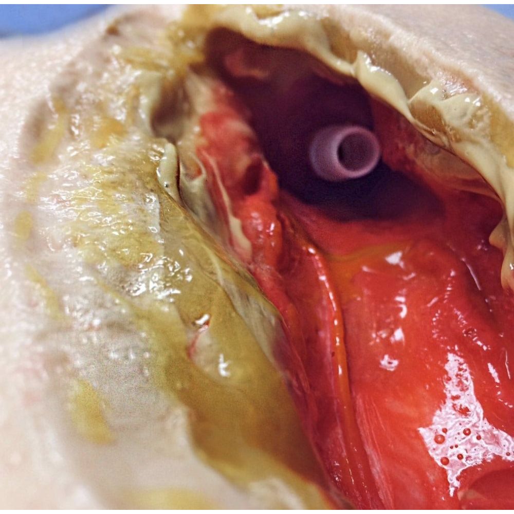 Precision Dermal Vascular Surgery Femoral Leg Simulator – Femoral Artery Anastomosis & Bypass Training Model UK MS-VAS-FEMLEG01
