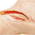 Precision Dermal Carotid Head Simulator – Vascular Surgery Training Model – Carotid Endarterectomy Practice – Realistic Surgical Simulation Head – (Professional Training Use) UK SIM-CAROTID-HEAD-VASC-01