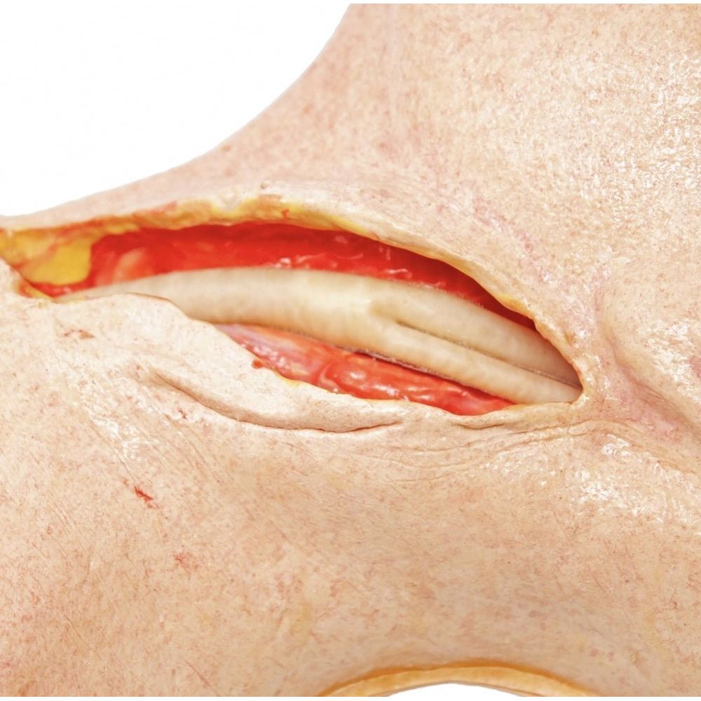 Precision Dermal Carotid Head Simulator – Vascular Surgery Training Model – Carotid Endarterectomy Practice – Realistic Surgical Simulation Head – (Professional Training Use) UK SIM-CAROTID-HEAD-VASC-01