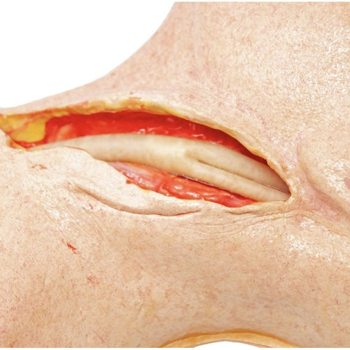 Precision Dermal Carotid Head Simulator – Vascular Surgery Training Model – Carotid Endarterectomy Practice – Realistic Surgical Simulation Head – (Professional Training Use) UK SIM-CAROTID-HEAD-VASC-01