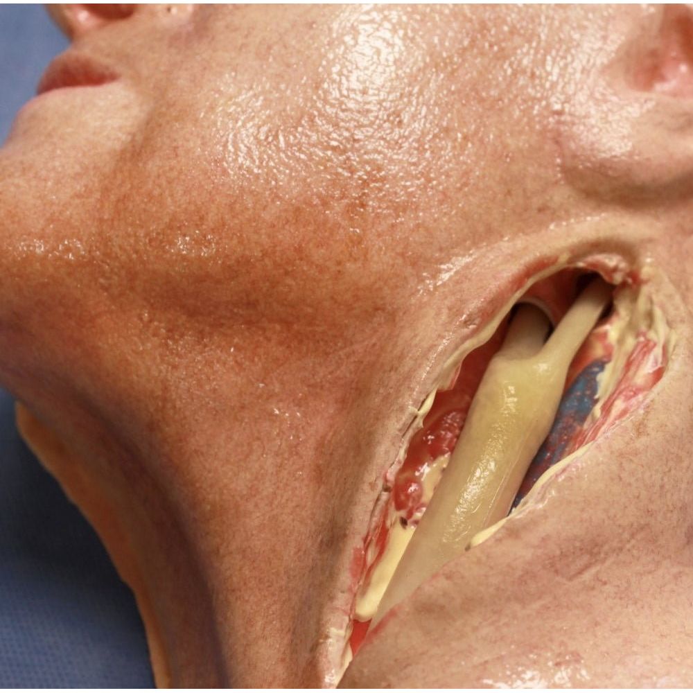 Precision Dermal Carotid Head Simulator – Vascular Surgery Training Model – Carotid Endarterectomy Practice – Realistic Surgical Simulation Head – (Professional Training Use) UK SIM-CAROTID-HEAD-VASC-01